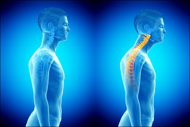 Bending Over and Proper Posture - The Lost Art